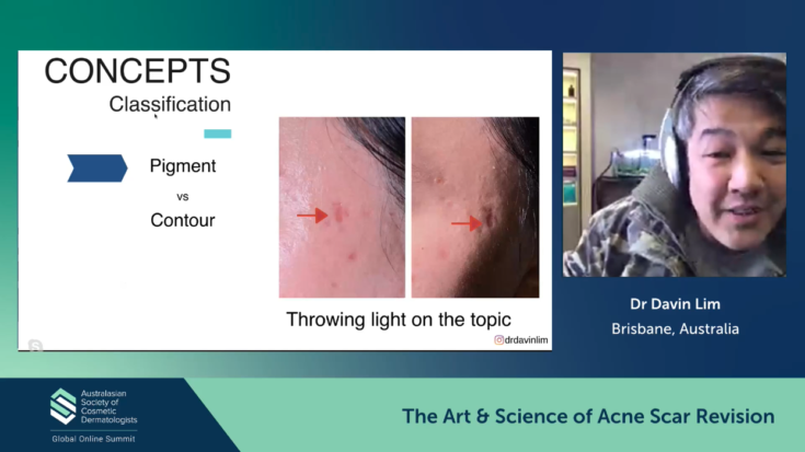 The Art & Science of Acne Scar Revision – Davin Lim